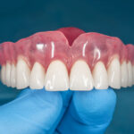 dentist holding full removable denture