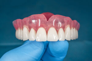 Custom-made cosmetic dentures held by a gloved hand, showcasing realistic teeth and gum contours, emphasizing advanced dental technology for enhanced aesthetics and comfort.