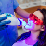in-office teeth whitening