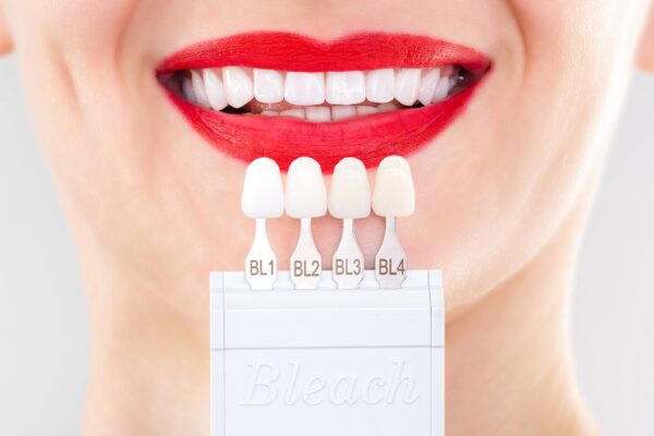 comparing tooth color for teeth whitening
