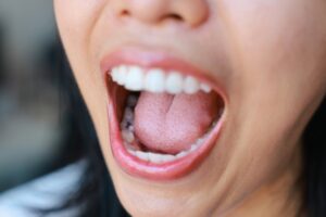 Close-up of an open mouth displaying healthy teeth and tongue, emphasizing oral health and the importance of addressing tooth discomfort.