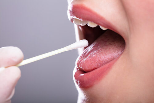 oral cancer screening swab