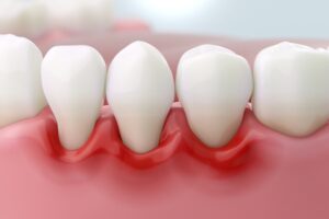 Close-up of healthy teeth and gums, emphasizing dental aesthetics and oral health, relevant to general dentistry and preventive care.